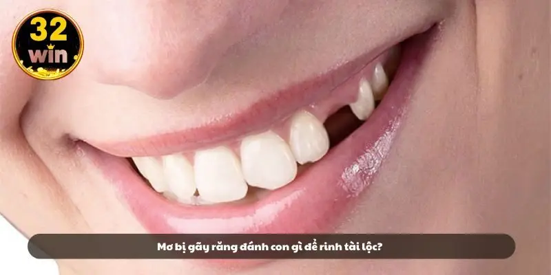 Mơ bị gãy răng đánh con gì để rinh tài lộc?